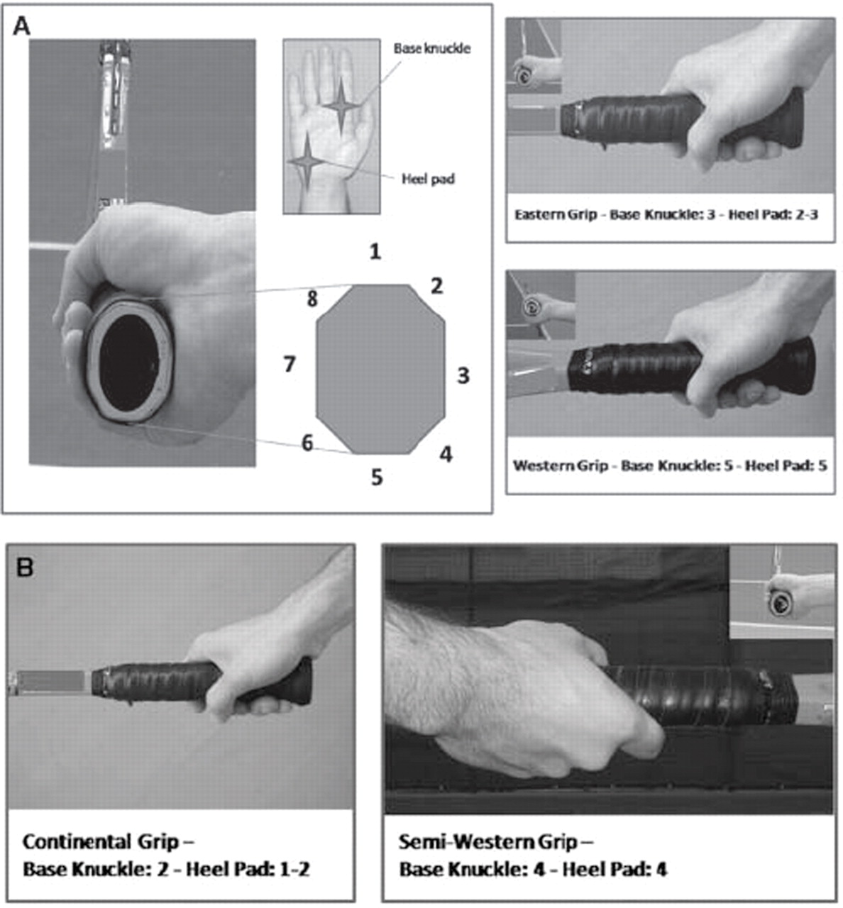 Knuckle Bursitis