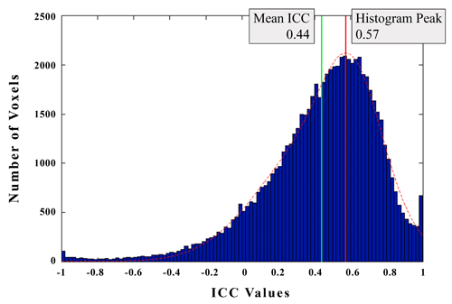 Negatively Skewed Curve Represents